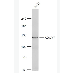 Anti-ADCY7  antibody-腺苷酸环化酶7抗体