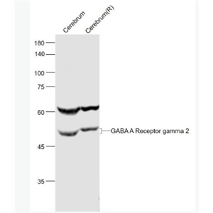 Anti-GABA A Receptor gamma 2 antibody-γ氨基丁酸γ2受体/GABAA Rγ2抗体