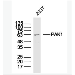 Anti-PAK1  antibody-p21激活激酶1抗体
