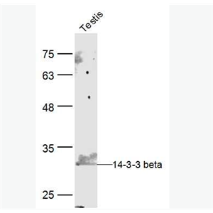 Anti-14-3-3 beta antibody-14-3-3β抗体
