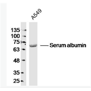 Anti-Albumin antibody-白蛋白抗体,Albumin
