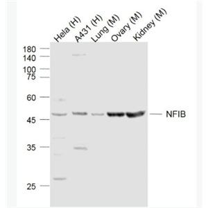 Anti-NFIB  antibody-核因子1B抗体