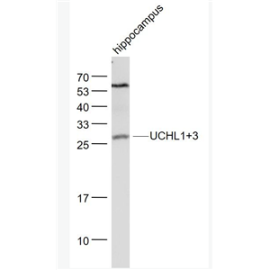 Anti-UCHL1+3 antibody-泛素硫酯酶L1+3抗体