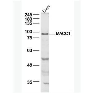 Anti-MACC1  antibody-结肠癌转移相关蛋白1抗体