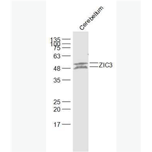 Anti-ZIC3 antibody-内脏异位相关蛋白/锌指蛋白203抗体