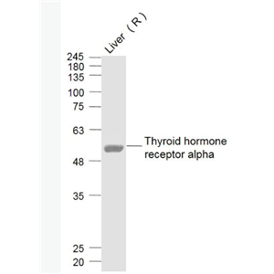 Anti-Thyroid hormone receptor alpha  antibody-甲狀腺激素受體α抗體,Thyroid hormone receptor alpha