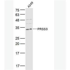 Anti-PRSS3 antibody-脑胰蛋白酶3抗体