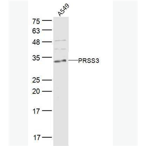 Anti-PRSS3 antibody-腦胰蛋白酶3抗體