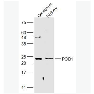 Anti-POD1 antibody-足细胞表达蛋白/转录因子21抗体