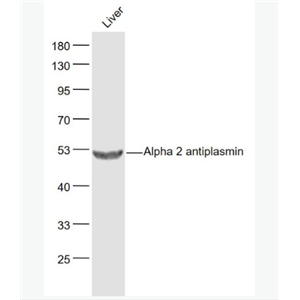 Anti-Alpha 2 antiplasmin antibody-α2纤溶酶色素上皮衍生因子抗体