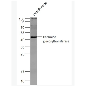 Anti-Ceramide glucosyltransferase  antibody-葡萄糖神经酰胺合成酶抗体,Ceramide glucosyltransferase
