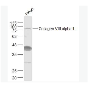 Anti-Collagen VIII alpha 1  antibody-8型胶原/内皮胶原蛋白抗体