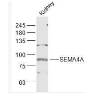 Anti-SEMA4A antibody-跨膜蛋白SEMA4A抗体