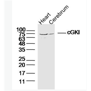 Anti-cGKI antibody-cGMP依赖性蛋白激酶1抗体