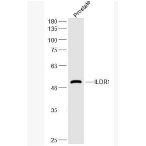 Anti-ILDR1 antibody-免疫球蛋白样结构域受体1抗体,ILDR1