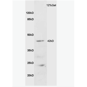 Anti-GALR2 antibody-甘丙肽受体2抗体