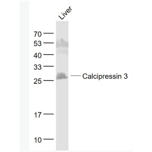 Anti-Calcipressin 3 antibody-钙调神经磷酸酶调节蛋白3抗体（唐氏综合征候选区域蛋白1样蛋白3）