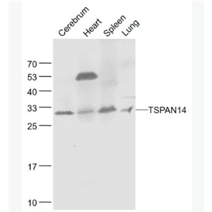 Anti-TSPAN14  antibody-四分子交联体14抗体（四旋蛋白）
