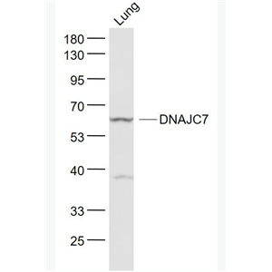 Anti-DNAJC7  antibody-DNAJC7蛋白抗體