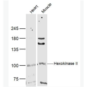 Anti-Hexokinase II antibody-己糖激酶2抗体