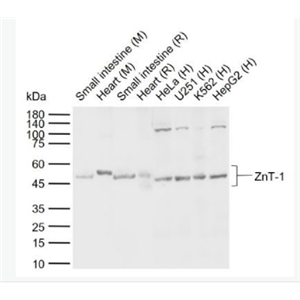 Anti-ZnT-1  antibody-锌转运蛋白1抗体