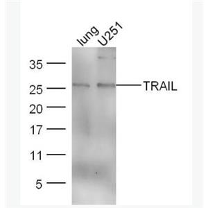 Anti-TRAIL antibody-肿瘤坏死因子相关凋亡诱导配体抗体,TRAIL