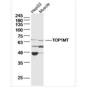 Anti-TOP1MTantibody-线粒体DNA拓普西异构酶Ⅰ抗体