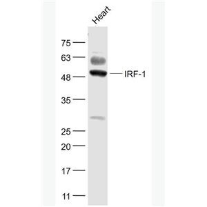 Anti-IRF1 antibody-干擾素調(diào)節(jié)因子1抗體