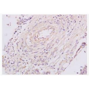 Anti-Granulin   antibody-颗粒蛋白前体抗体