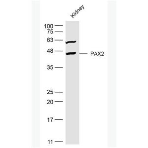 Anti-PAX2 antibody-配对盒基因2抗体