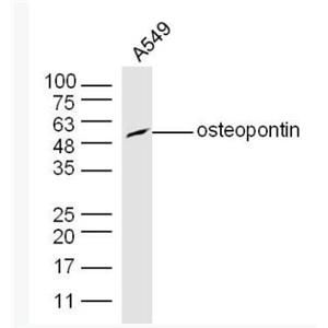 Anti-Osteopontin antibody-骨桥蛋白/分泌型磷蛋白1抗体