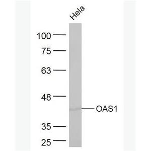 Anti-OAS1   antibody-寡腺苷酸合成酶-1抗体