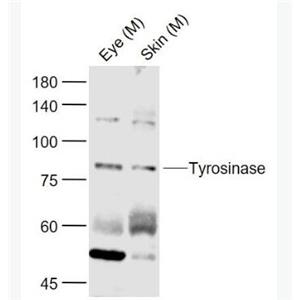 Anti-Tyrosinase  antibody-酪氨酸酶抗体