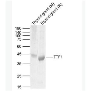 Anti-TTF1/NKX2-1 antibody-甲状腺核转录因子-1抗体