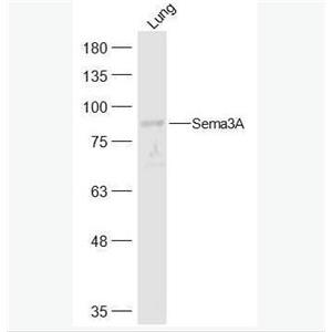 Anti-Sema3A  antibody-臂板蛋白3A抗体