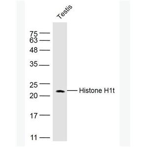 Anti-Histone H1t antibody-组蛋白H1抗体,Histone H1t