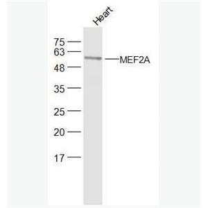 Anti-DMEF2A  antibody-肌细胞增强因子2抗体