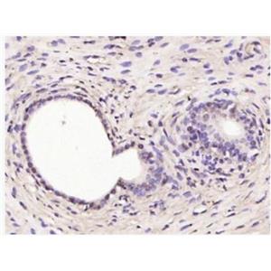 Anti-RSL1D1  antibody-细胞衰老抑制基因抗体