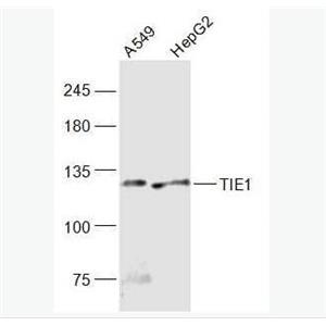 Anti-TIE1  antibody-血管生成素受体1抗体