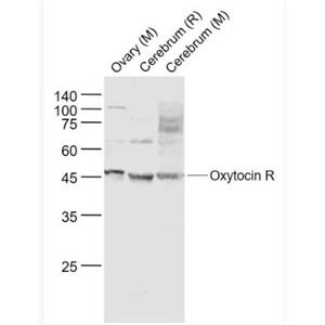 Anti-Oxytocin R  antibody-催产素受体(缩宫素受体)抗体