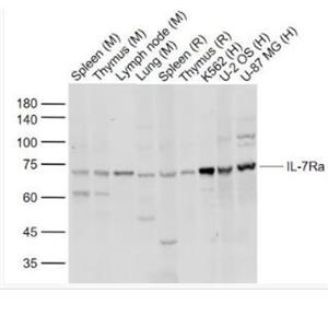 Anti-IL7R antibody-白细胞介素-7受体a（CD127）抗体,IL7R
