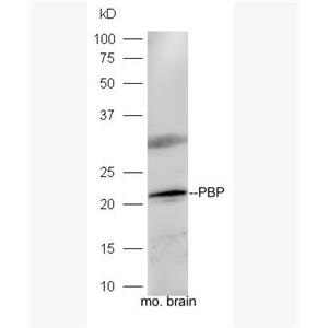 Anti-PBP antibody-磷脂酰乙醇胺结合蛋白1抗体