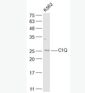 Anti-C1QA antibody-补体C1qα链多肽抗体,C1QA