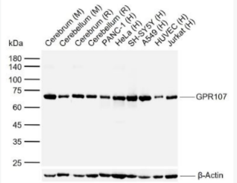 Anti-GPR107 antibody-G蛋白偶联受体107抗体,GPR107