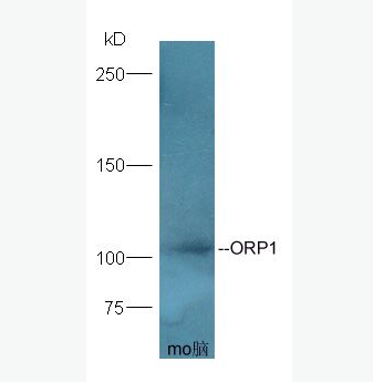 Anti-ORP1 antibody-氧固醇结合蛋白样1A抗体,ORP1