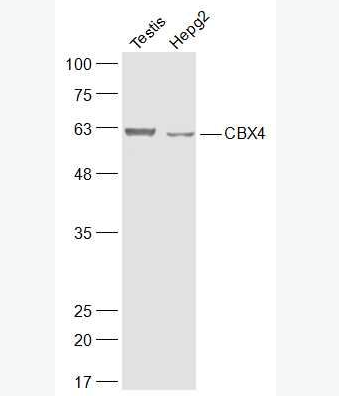 Anti-CBX4 antibody-染色盒同源物4抗体,CBX4