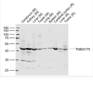 Anti-TMEM175 antibody-跨膜蛋白175抗體,TMEM175