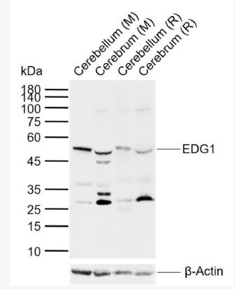 Anti-EDG1  antibody-内皮细胞分化鞘脂G蛋白偶联受体1抗体,EDG1