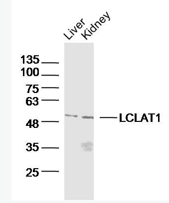 Anti-LCLAT1 antibody-心磷脂酰基转移酶1抗体,LCLAT1