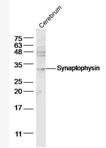 Anti-Synaptophysin  antibody-突觸小泡蛋白P38抗體,Synaptophysin